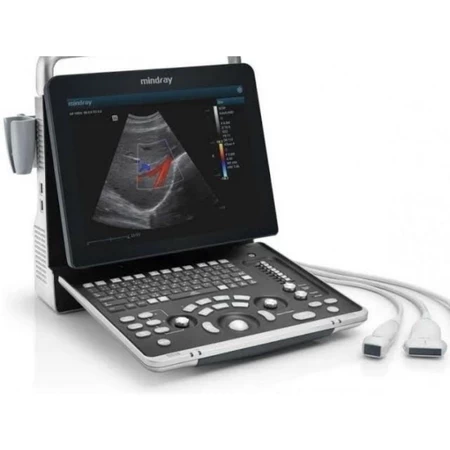 Mindray Z5 New Version Z50 Color Doppler