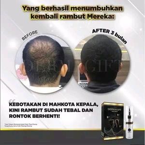 Serum Control pervial 9x5